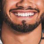 تاثیر لبخند بر روی زیبایی